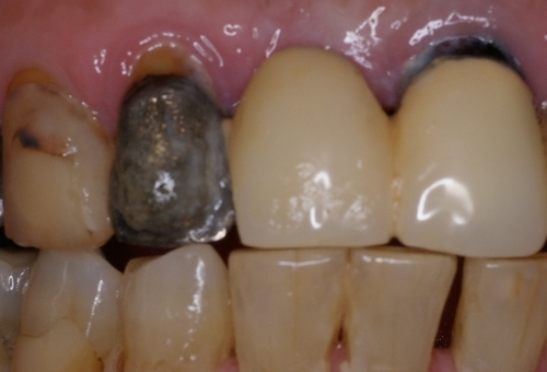 niigata_ whitening_repair1.jpg